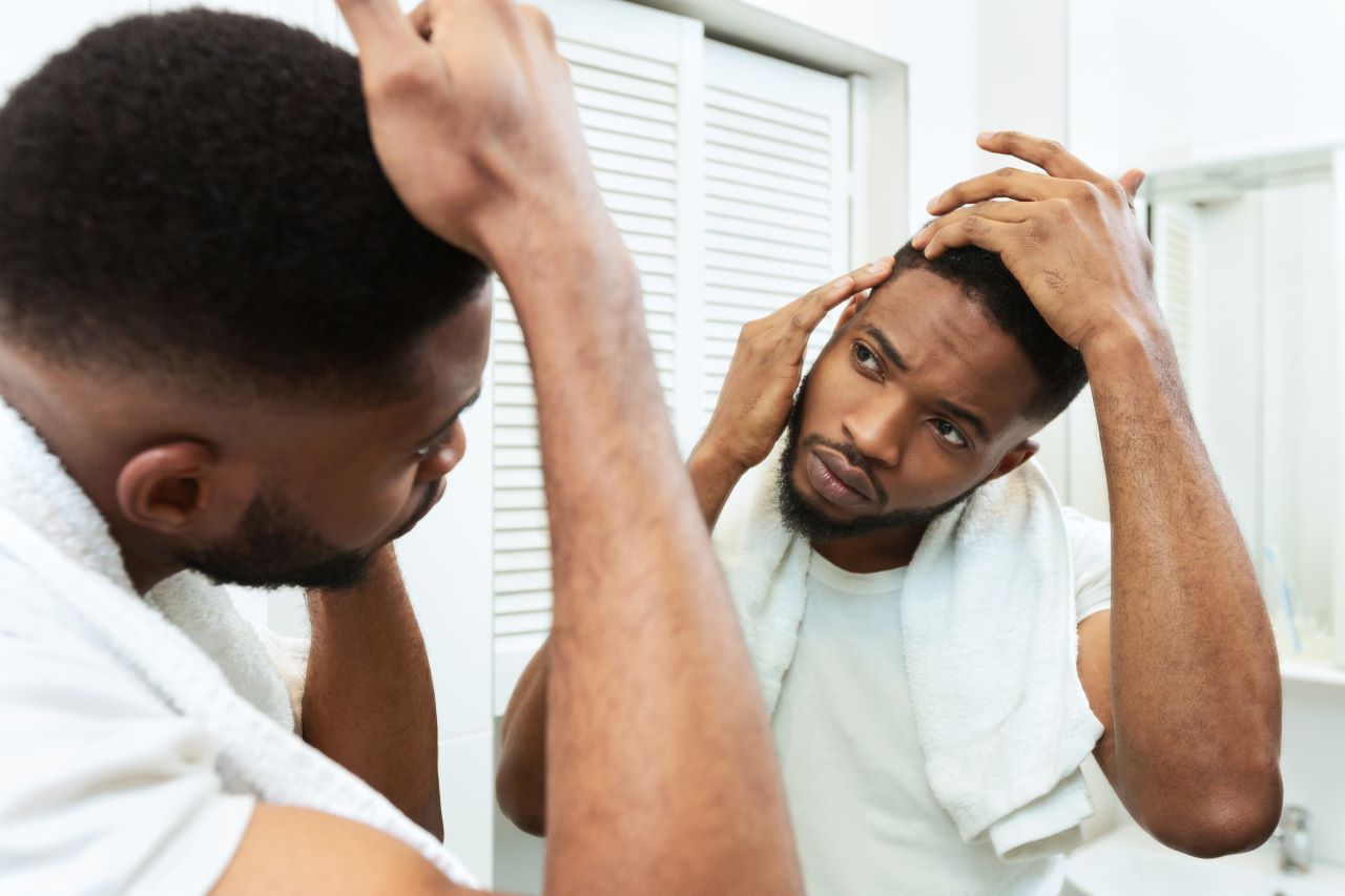 Top tips for slowing male hair loss