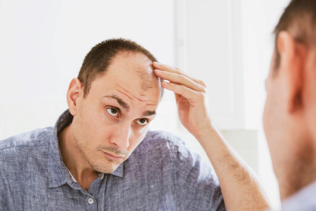 Male pattern baldness – what treatments really work?